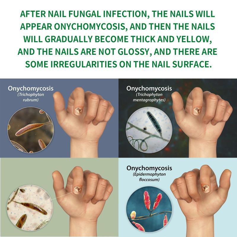 Heal Natural Nail Treatment Oil