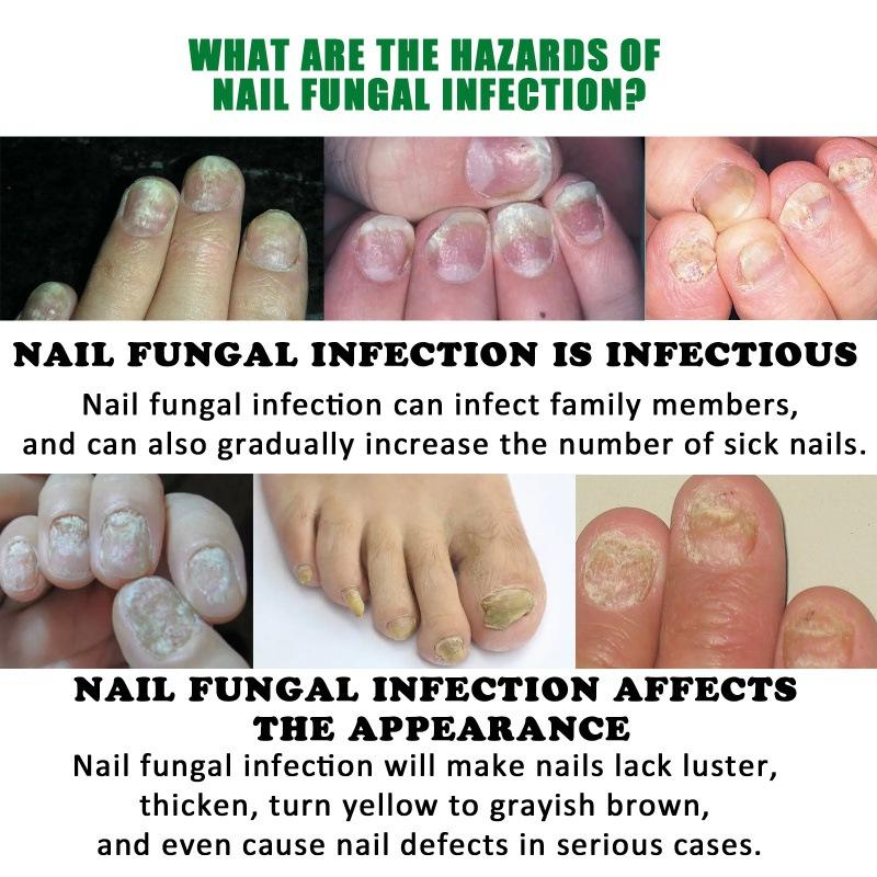 Heal Natural Nail Treatment Oil