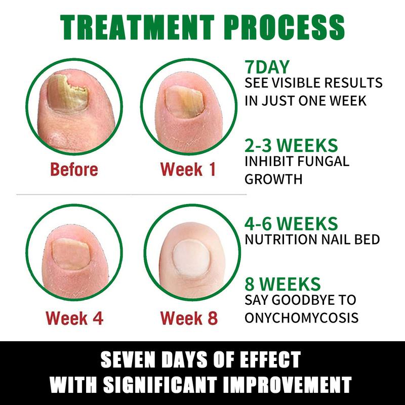 Heal Natural Nail Treatment Oil