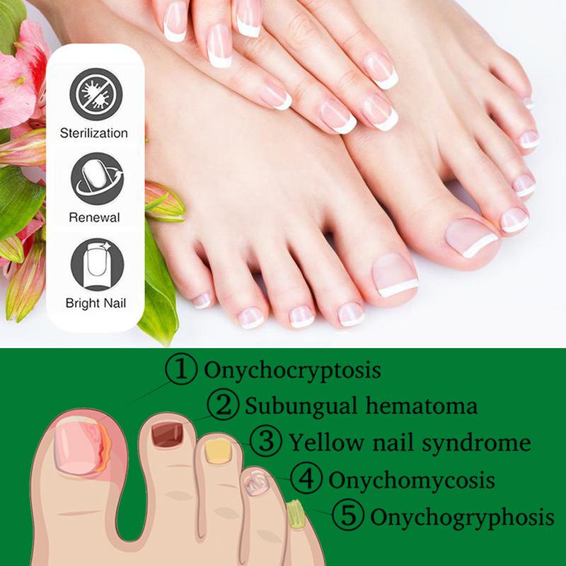 Heal Natural Nail Treatment Oil