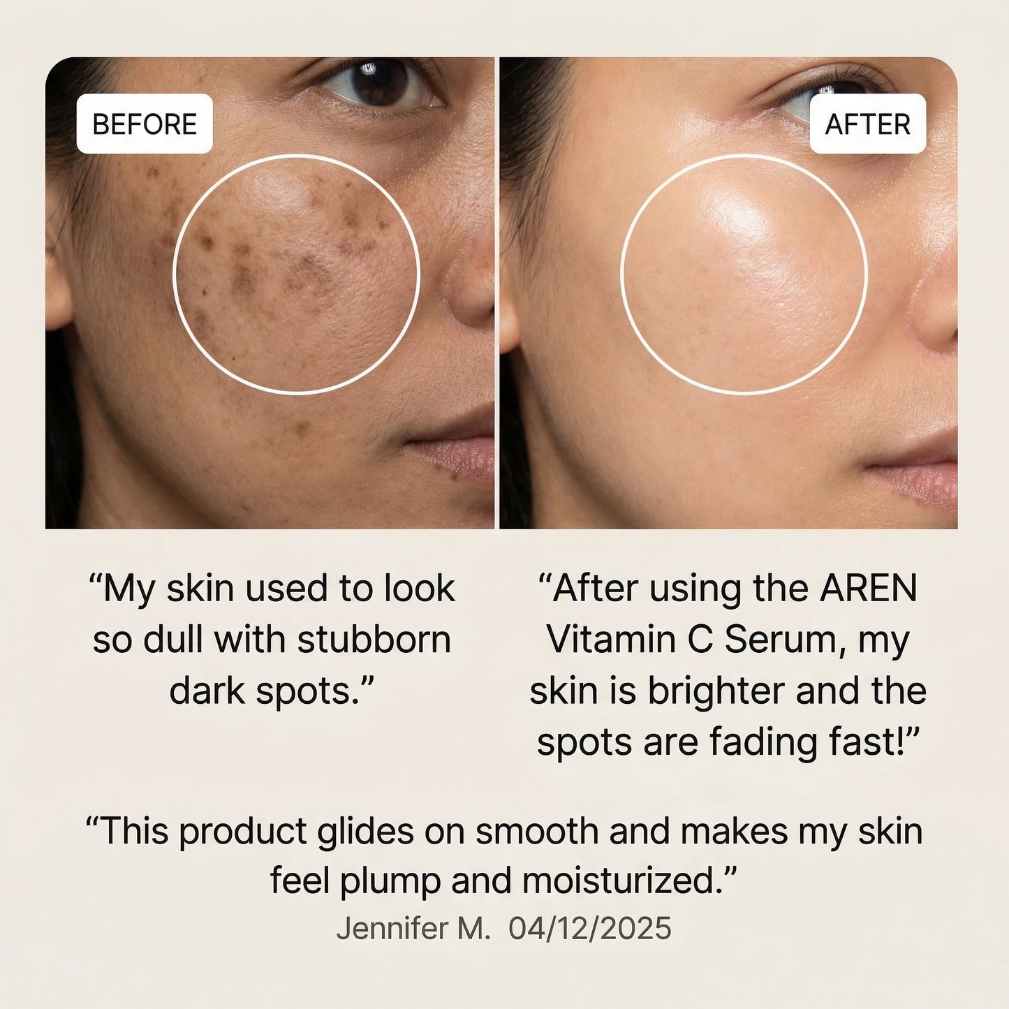 Vitamin C Serum - Radiance Complex