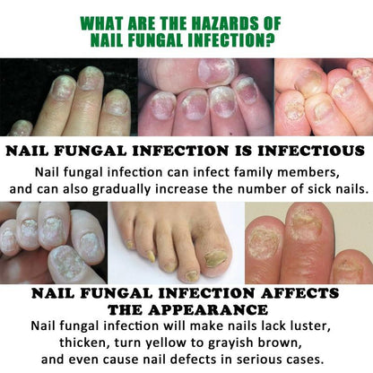 Heal Natural Nail Treatment Oil