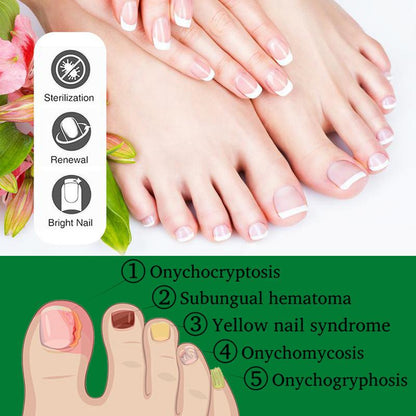 Heal Natural Nail Treatment Oil